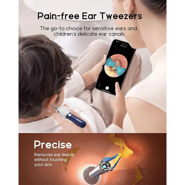 Bebird R37R Ear Cleaning Camera Wax Removal Tool kit