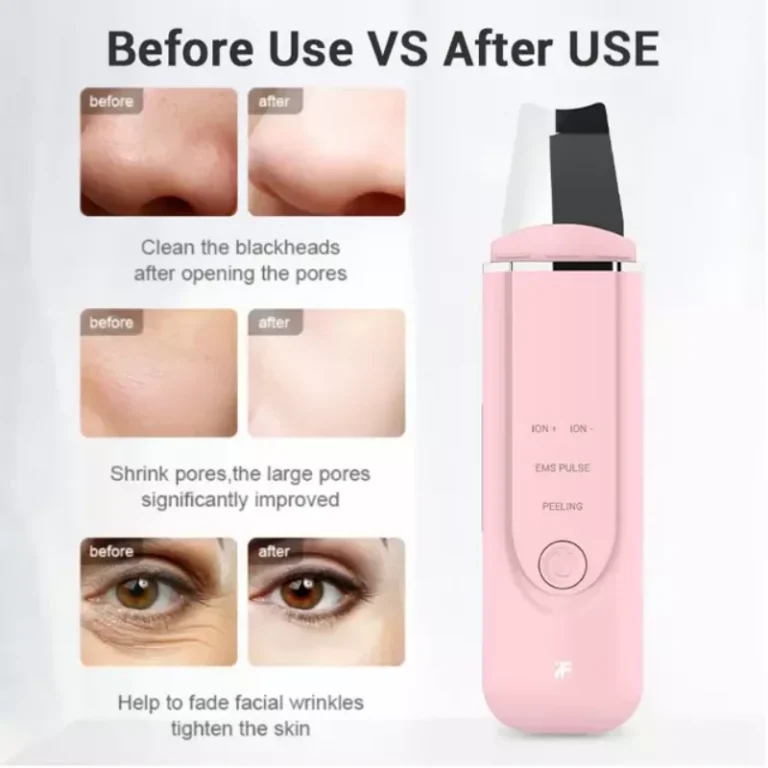 Xiaomi MS7100 InFace Ultrasonic Ionic Cleaner